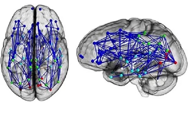 Mapa neuronowa mózgu typowego mężczyzny - Mózgi kobiet i mężczyzn