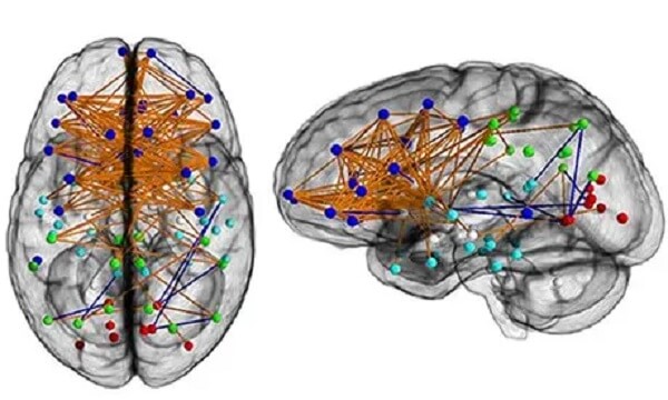 Mapa neuronowa mózgu typowej kobiety